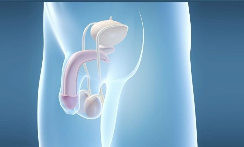 Protesimplantation är en kirurgisk metod för att förstora den manliga penisen