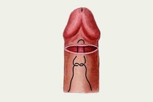 hur att öka penis